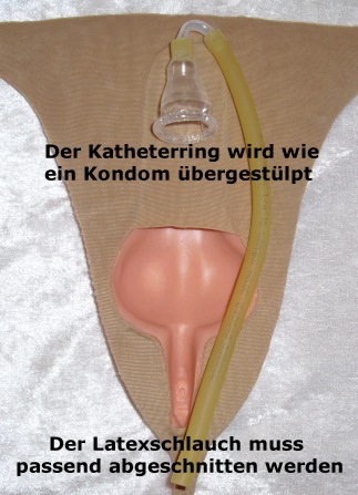 Katheter für das "kleine Geschäft"